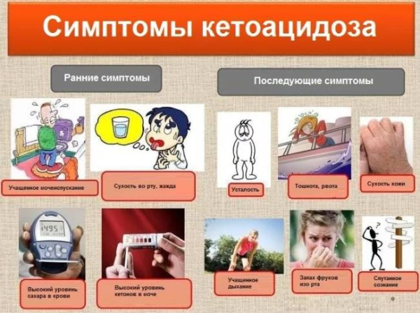 Что произойдет, если диабет 2 типа не лечить