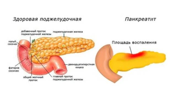 Почему болит желудок после еды