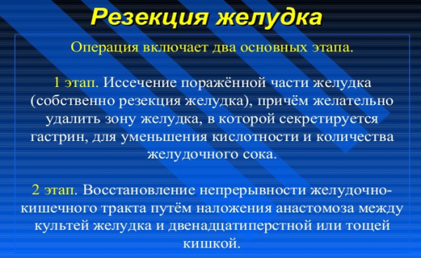Резекция желудка