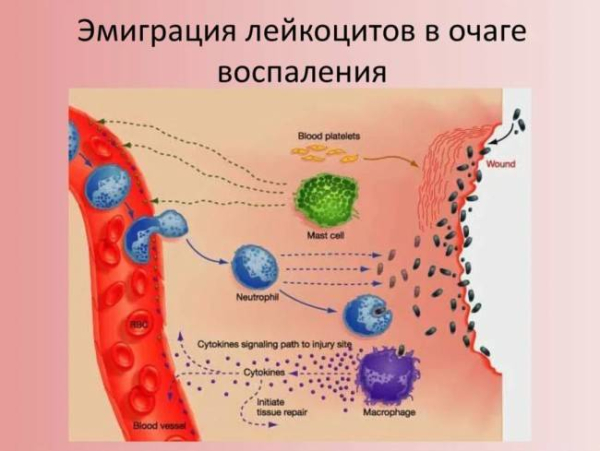 Что такое воспаление
