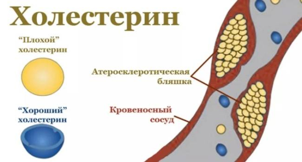 6 симптомов гипотиреоза у пожилых людей 6 симптомов гипотиреоза у пожилых людей