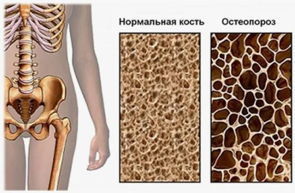Почему вы чаще травмируетесь после 40 лет Почему вы чаще травмируетесь после 40 лет