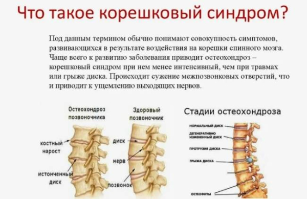Патофизиология боли в спине
