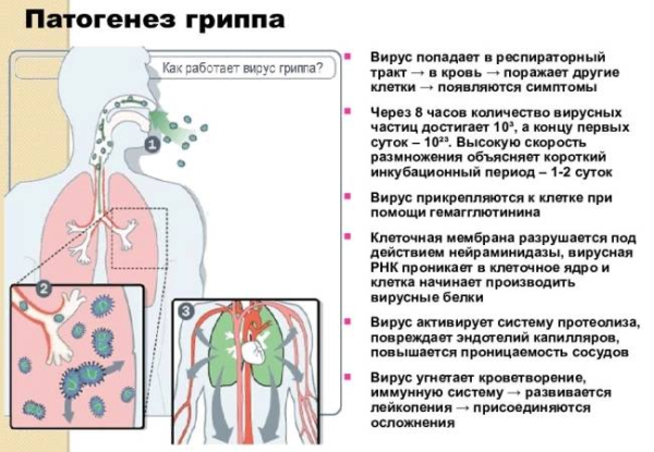 Что такое грипп Что такое грипп