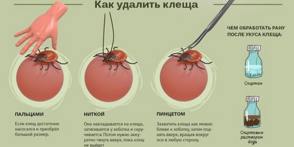 Куда обращаться, если укусил клещ - алгоритм действий, проведение анализа крови и исследования паразита Куда обращаться, если укусил клещ - алгоритм действий, проведение анализа крови и исследования паразита