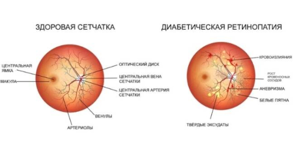 11 причин нечеткости зрения 11 причин нечеткости зрения
