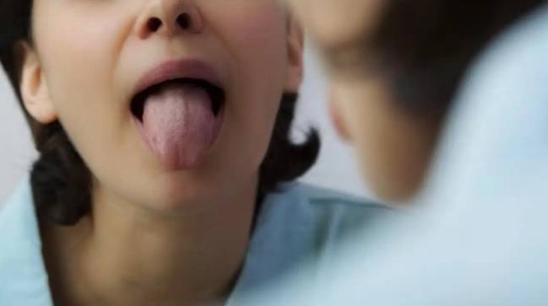 Что означают изменения цвета на языке