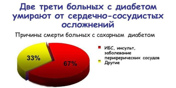 Изменения в сердце после 50 о которых важно знать