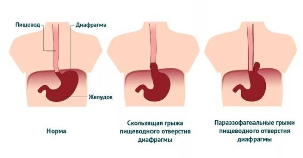 Почему кислотность увеличивается с возрастом